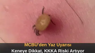 MCBÜ’den Yaz Uyarısı Keneye Dikkat, KKKA Riski Artıyor